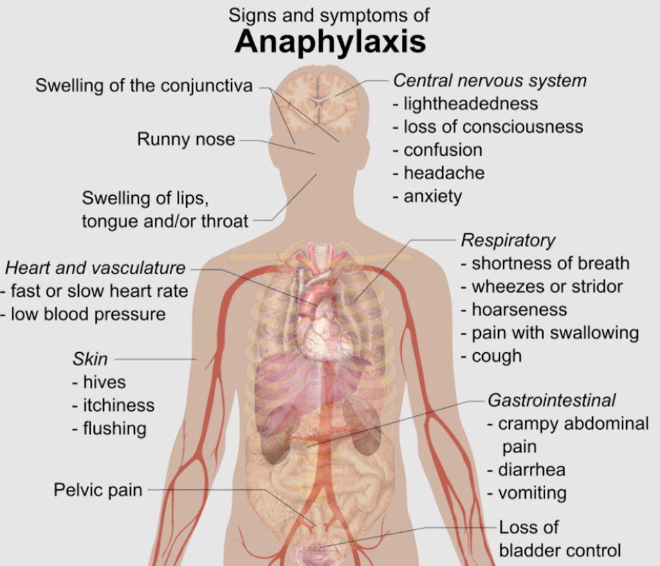 Signs and symptoms of anaphylaxis