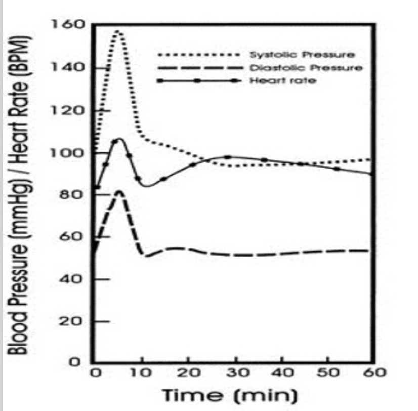 Chart showing time to onset of Epinephrine intramuscularly