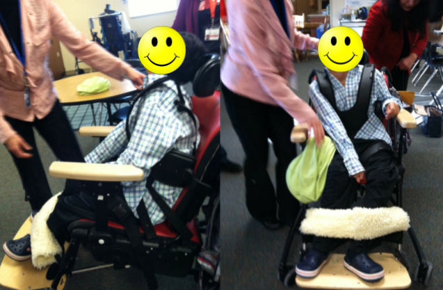 A young man in a wheelchair seating system with kyphosis, lateral sclerosis, and neck hyperextension