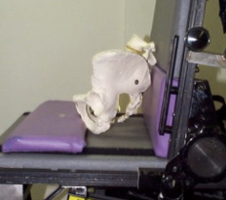 This is a PSIS pad behind and an anti-thrust curb in front of the skeletal pelvis to prevent a posterior pelvic tilt.