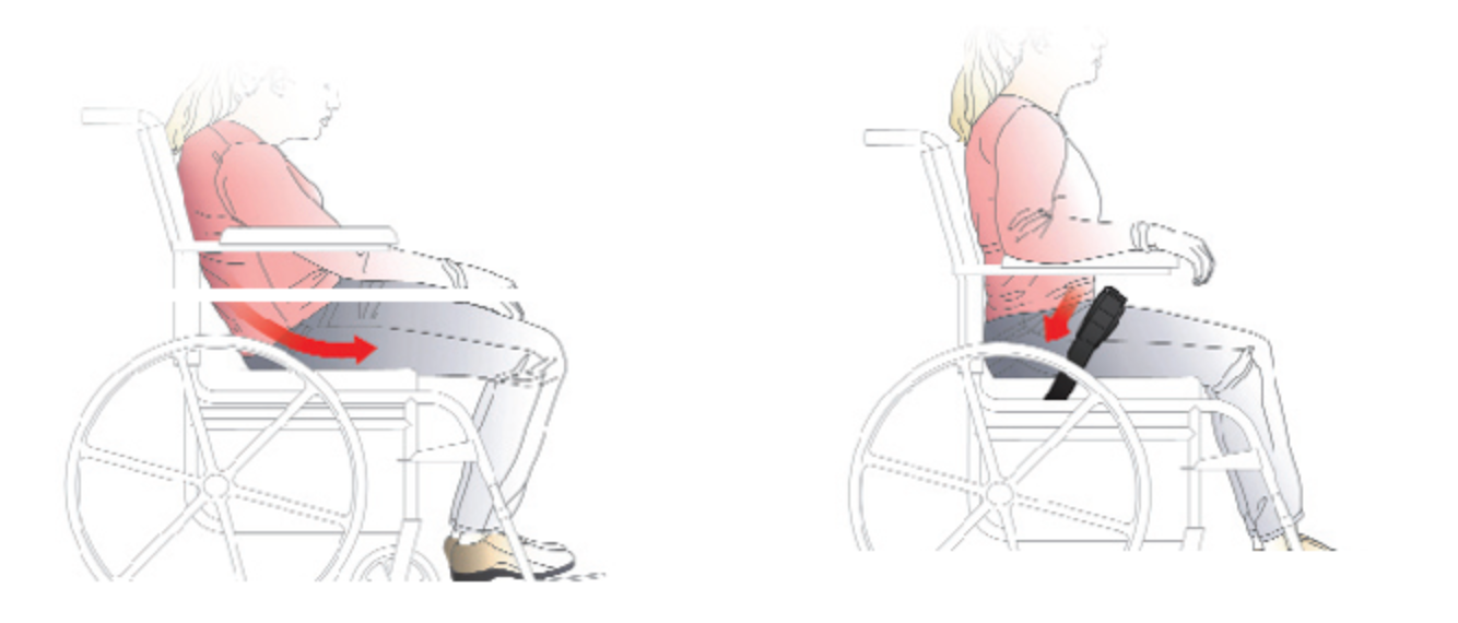 This is a side by side comparison of a two drawings of a woman in a manual wheelchair. In the first, she is sliding forward in a posterior pelvic tilt. In the second, she is properly positioned using a 60-degree pelvic positioning belt.