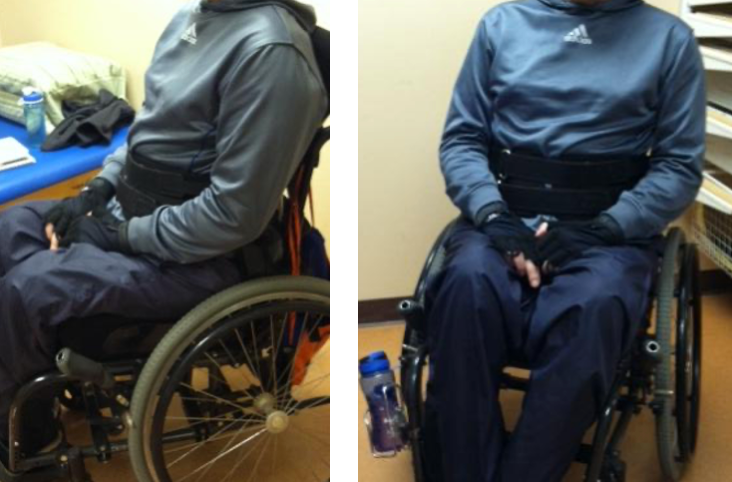 Side and lateral views of a client in a wheelchair using a belly binder