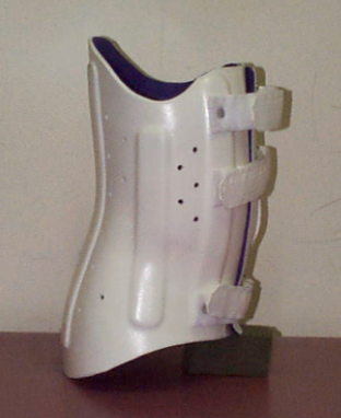 Example of an orthotic (TLSO) to maintain an upright posture