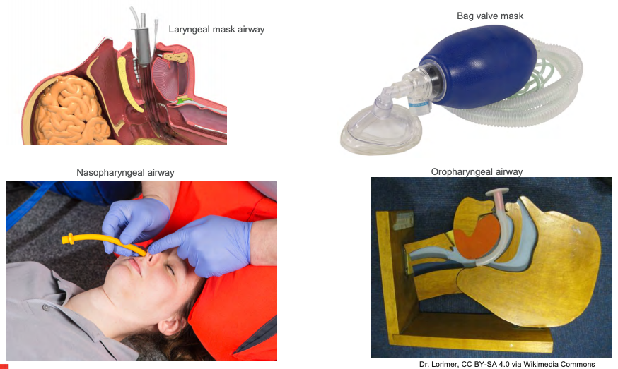 Airway Equipment