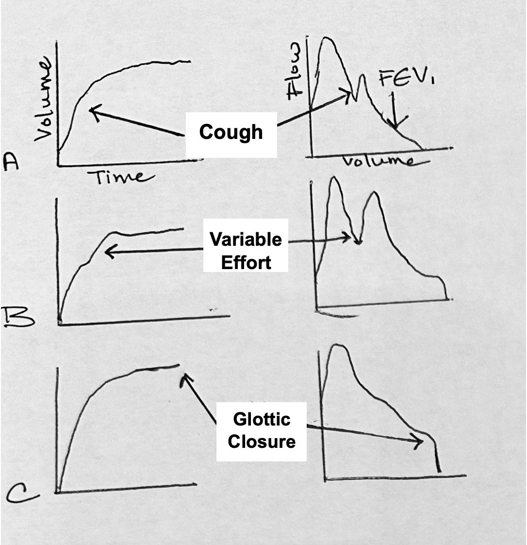 Volume and flow graphs illustrating spirometry efforts